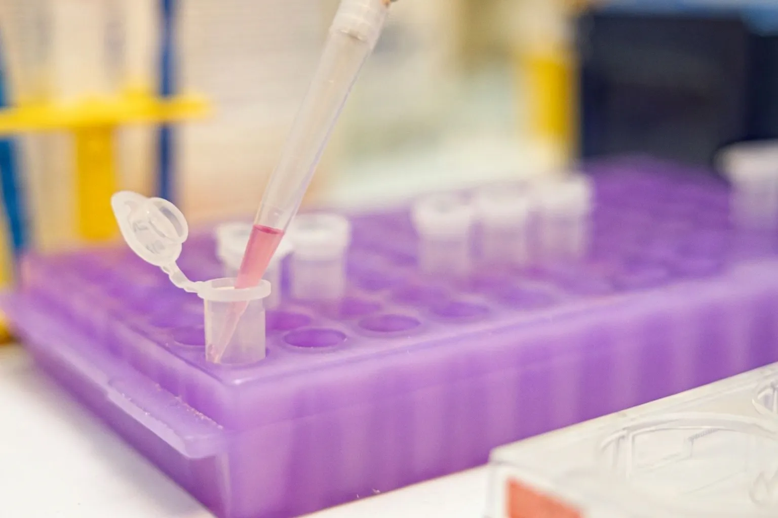 Cancer du sein : la molécule CD1d ouvre une voie thérapeutique