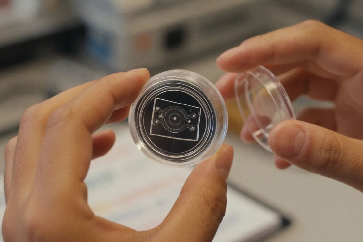 Tumeurs sur puce : une innovation de précision pour personnaliser le traitement du cancer du sein